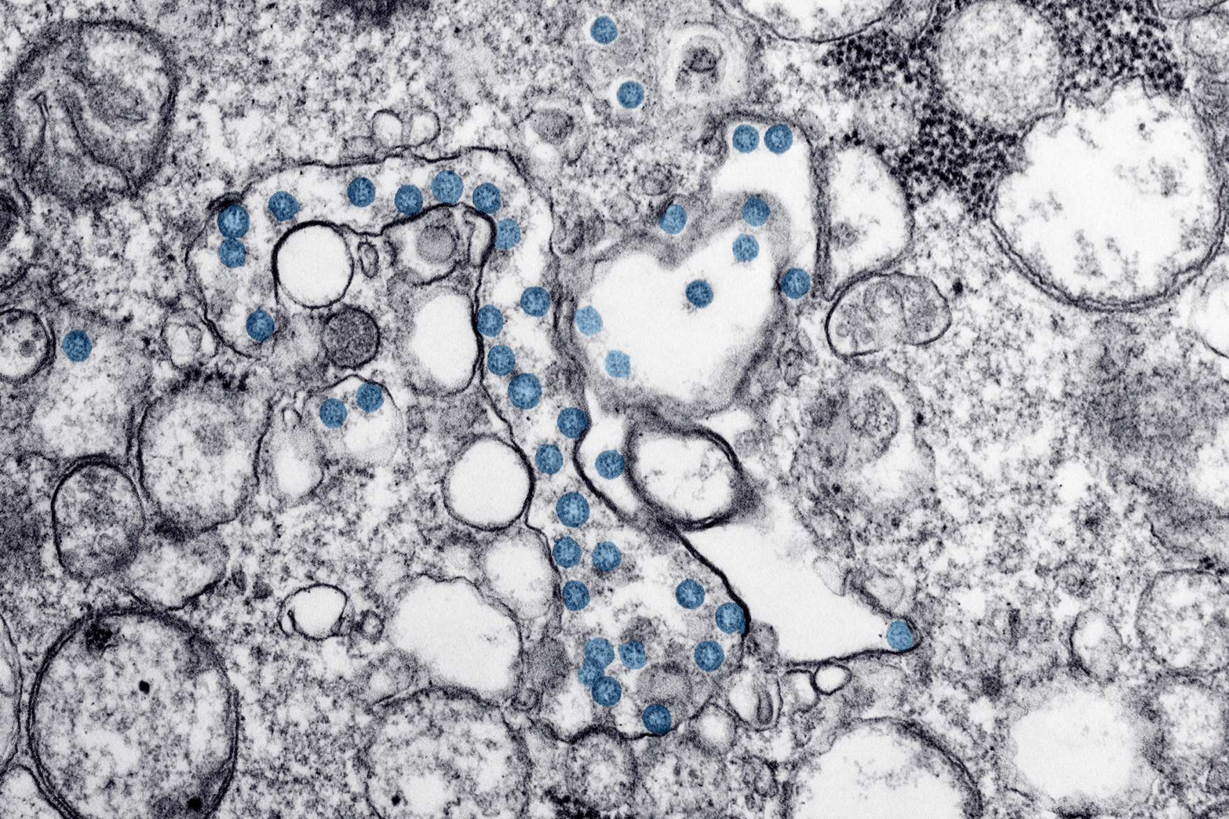 What role does COVID-19 play in this issue?